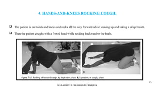 SELF-ASSISTED COUGHING TECHNIQUES IN PHYSIOTHERAPY.pptx