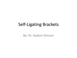 Self-Ligating Brackets
By: Dr. Hadeel Almasri
 