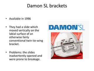 Damon SL brackets
• Available in 1996
• They had a slide which
moved vertically on the
labial surface of an
otherwise fairly
conventional twin tie-wing
bracket.
• Problems: the slides
inadvertently opened and
were prone to breakage.
 