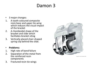 Damon 3
• 3 major changes:
1. A tooth-coloured composite
resin base and upper tie-wing
which reduces the visual impact
of the bracket
2. A rhomboidal shape of the
bracket and slide which
facilitates bracket siting
3. Vertically placed chair-shaped
spring clip behind the slide.
• Problems:
1. High rate of bond failure
2. Separation of the metal from
the reinforced resin
components
3. Fractured resin tie-wings
 