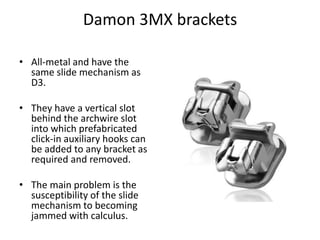 Damon 3MX brackets
• All-metal and have the
same slide mechanism as
D3.
• They have a vertical slot
behind the archwire slot
into which prefabricated
click-in auxiliary hooks can
be added to any bracket as
required and removed.
• The main problem is the
susceptibility of the slide
mechanism to becoming
jammed with calculus.
 