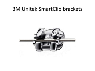3M Unitek SmartClip brackets
 