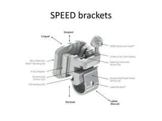 SPEED brackets
 