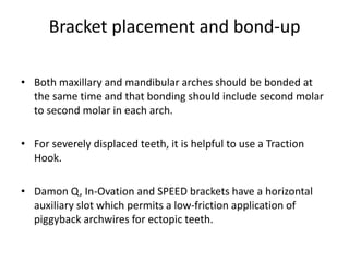 Bracket placement and bond-up
• Both maxillary and mandibular arches should be bonded at
the same time and that bonding should include second molar
to second molar in each arch.
• For severely displaced teeth, it is helpful to use a Traction
Hook.
• Damon Q, In-Ovation and SPEED brackets have a horizontal
auxiliary slot which permits a low-friction application of
piggyback archwires for ectopic teeth.
 