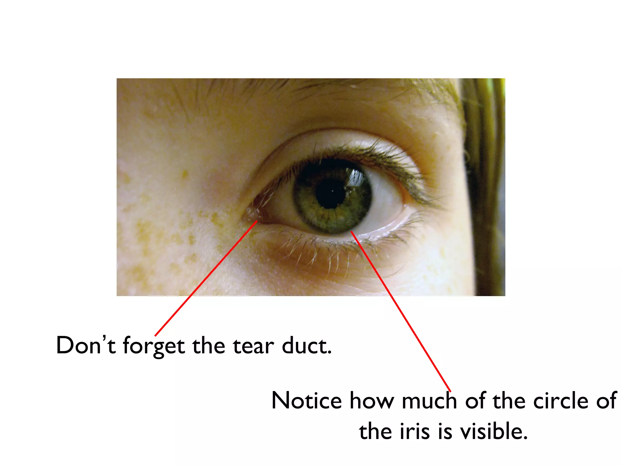 Don’t forget the tear duct.

                    Notice how much of the circle of
                            the iris is visible.
 