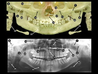 Perfect Pan Radiograph Self study-pan-anatomy | PPT