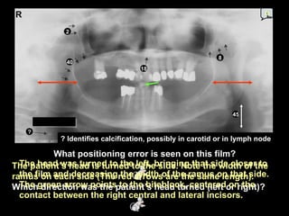 Perfect Pan Radiograph Self study-pan-anatomy | PPT