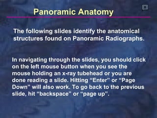 The following slides identify the anatomical structures found on Panoramic Radiographs.  0 Panoramic Anatomy In navigating through the slides, you should click on the left mouse button when you see the mouse holding an x-ray tubehead or you are done reading a slide. Hitting “Enter” or “Page Down” will also work. To go back to the previous slide, hit “backspace” or “page up”.  