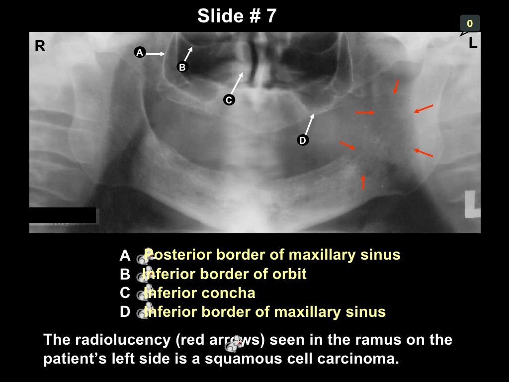 Self studypananatomy