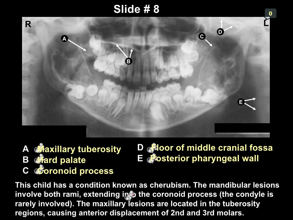 Self studypananatomy
