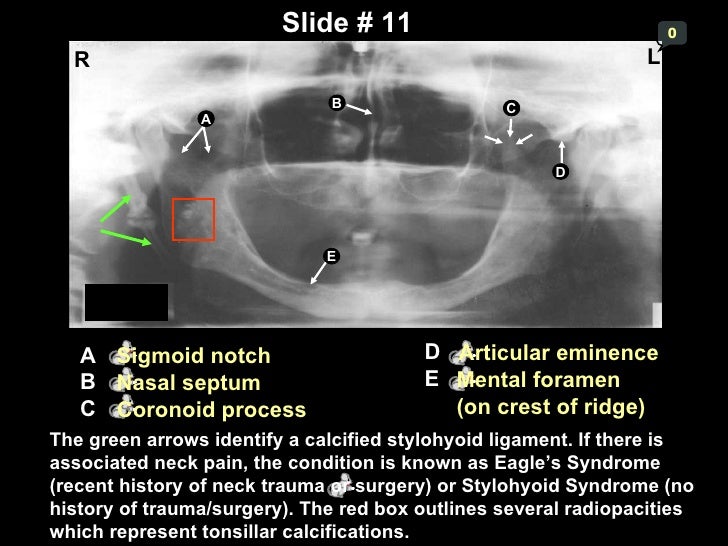 Self study-pan-anatomy