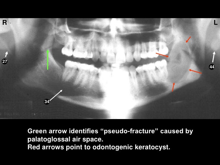 Self study-pan-anatomy