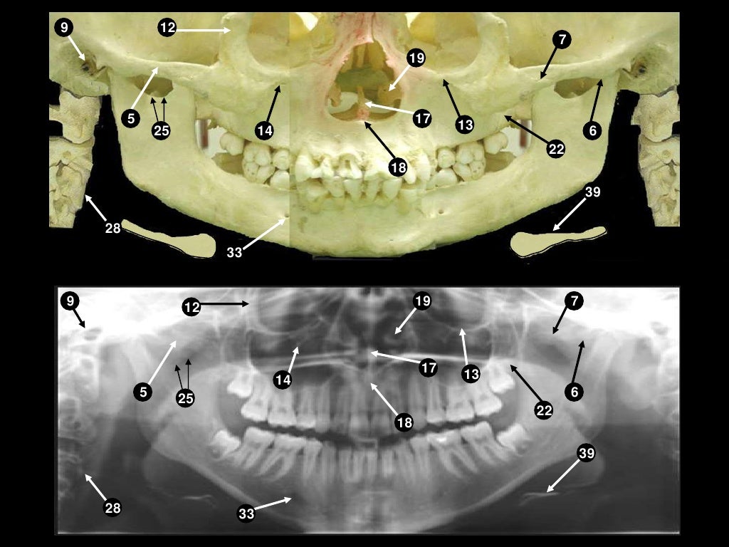 Self studypananatomy