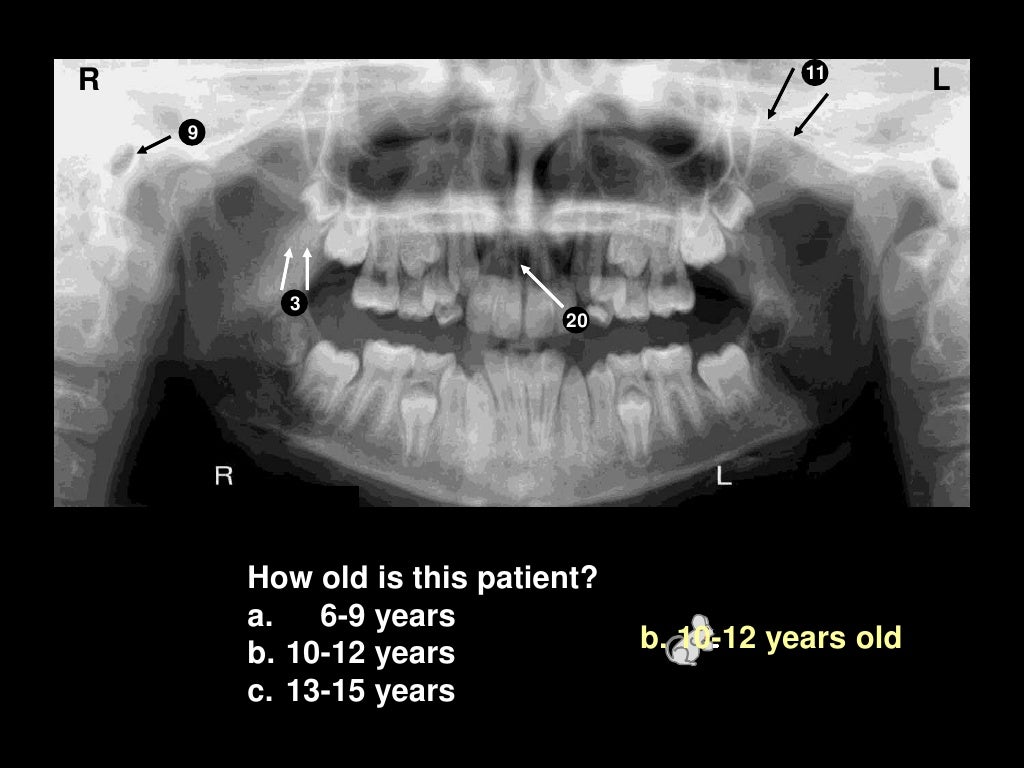 Self studypananatomy