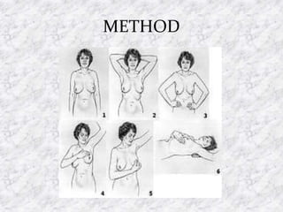 METHOD
 
