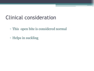 Clinical consideration
▫ This open bite is considered normal
▫ Helps in suckling
 