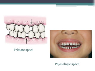 Primate space
Physiologic space
 