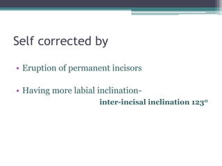 Self corrected by
• Eruption of permanent incisors
• Having more labial inclination-
inter-incisal inclination 1230
 