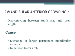 2)MANDIBULAR ANTERIOR CROWDING :
• Disproportion between tooth size and arch
length
Cause :
▫ Exchange of larger permanent mandibular
incisors
▫ In narrow lower arch
 