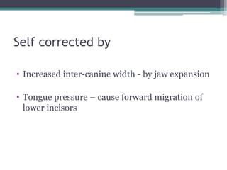 Self corrected by
• Increased inter-canine width - by jaw expansion
• Tongue pressure – cause forward migration of
lower incisors
 