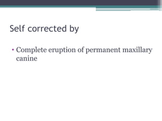 Self corrected by
• Complete eruption of permanent maxillary
canine
 