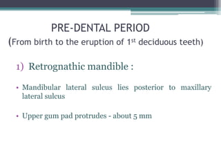 PRE-DENTAL PERIOD
(From birth to the eruption of 1st deciduous teeth)
1) Retrognathic mandible :
• Mandibular lateral sulcus lies posterior to maxillary
lateral sulcus
• Upper gum pad protrudes - about 5 mm
 