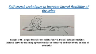 Self stretch techniques to increase lateral flexibility of
the spine
Patient with a right thoracic left lumbar curve. Patient actively stretches
thoracic curve by reaching upward on side of concavity and downward on side of
convexity.
 