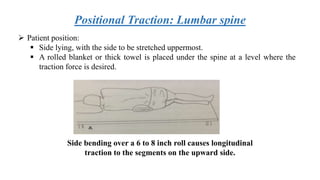 Positional Traction: Lumbar spine
 Patient position:
 Side lying, with the side to be stretched uppermost.
 A rolled blanket or thick towel is placed under the spine at a level where the
traction force is desired.
Side bending over a 6 to 8 inch roll causes longitudinal
traction to the segments on the upward side.
 