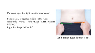 Common signs for right anterior Innominate:
Functionally longer leg length on the right
Anteriorly rotated ilium (Right ASIS appears
inferior)
Right PSIS superior vs. left..
ASIS Height Right inferior to left
 