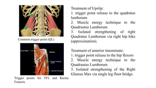 Treatment of Upslip:
1. trigger point release to the quadratus
lumborum
2. Muscle energy technique to the
Quadrautus Lumborum
3. Isolated strengthening of right
Quadratus Lumborum via right hip hike
(approximation).
Treatment of anterior innominate:
1. trigger point release to the hip flexors
2. Muscle energy technique to the
Quadrautus Lumborum
3. Isolated strengthening of the Right
Gluteus Max via single leg floor bridge.
Common trigger point (QL)
Trigger points for TFL and Rectus
Femoris
 