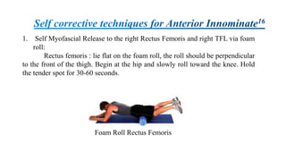 1. Self Myofascial Release to the right Rectus Femoris and right TFL via foam
roll:
Rectus femoris : lie flat on the foam roll, the roll should be perpendicular
to the front of the thigh. Begin at the hip and slowly roll toward the knee. Hold
the tender spot for 30-60 seconds.
Foam Roll Rectus Femoris
 
