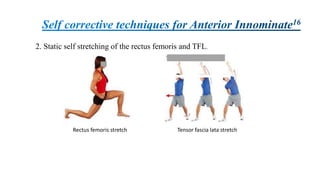 2. Static self stretching of the rectus femoris and TFL.
Rectus femoris stretch Tensor fascia lata stretch
 