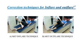 A) MET INFLARE TECHNIQUE B) MET OUTFLARE TECHNIQUE
 