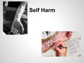 Self Harm
 