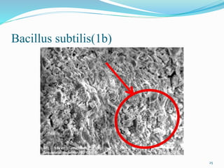 Bacillus subtilis(1b)
25
 