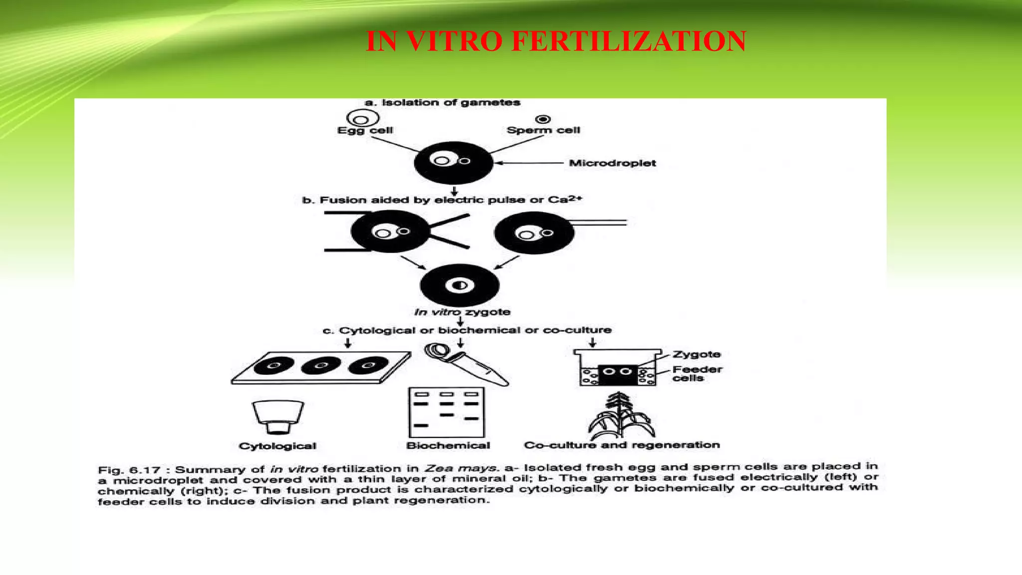IN VITRO FERTILIZATION
 
