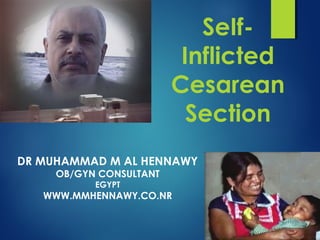 SeIf-
Inflicted
Cesarean
Section
DR MUHAMMAD M AL HENNAWY
OB/GYN CONSULTANT
EGYPT
WWW.MMHENNAWY.CO.NR
 