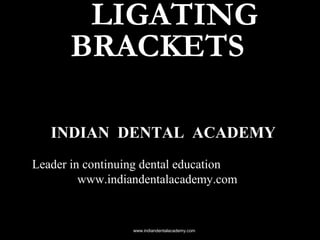 LIGATING
BRACKETS
INDIAN DENTAL ACADEMY
Leader in continuing dental education
www.indiandentalacademy.com

www.indiandentalacademy.com

 