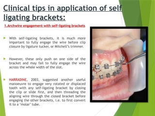 SELF LIGATING BRACKETS In orthodontics as | PPTX