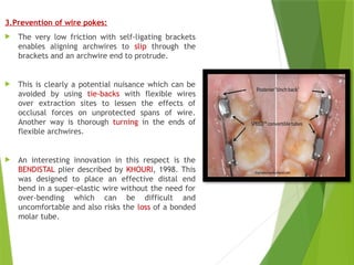 SELF LIGATING BRACKETS In orthodontics as | PPTX