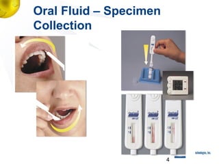 Oral Fluid – Specimen
Collection

4

 