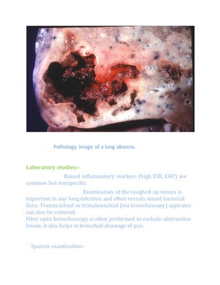 Pathology image of a lung abscess.
Laboratory studies:-
Raised inflammatory markers (high ESR, CRP) are
common but nonspecific.
Examination of the coughed up mucus is
important in any lung infection and often reveals mixed bacterial
flora. Transtracheal or transbronchial (via bronchoscopy) aspirates
can also be cultured.
Fiber optic bronchoscopy is often performed to exclude obstructive
lesion; it also helps in bronchial drainage of pus.
Sputum examination:-
 