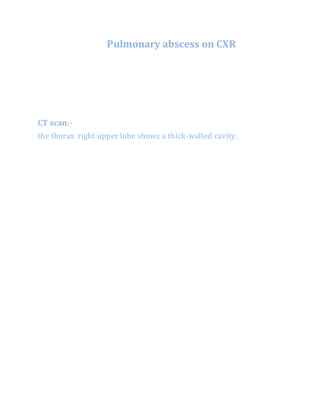 Pulmonary abscess on CXR
CT scan:-
the thorax right upper lobe shows a thick-walled cavity.
 