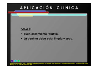 A P L I C A C I Ó N C L I N I C A
PASO 1PASO 1:
• Buen asilamiento relativo.• Buen asilamiento relativo.
• La dentina debe estar limpia y seca.
Scopin de Andrade O et al. Selamento imediato da dentina em protese fixa. Aplicacao e consideracoes clínicas. R Dental Press Estét,
Maringa, v5, n1, p 55-68, ja/fev/mar/ 2008.
 