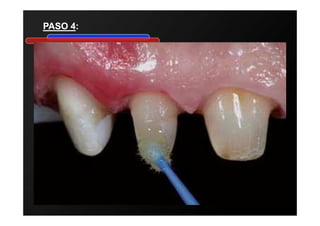 Y O U R T O P I C G O E S H E R E
• Your Subtopics Go Here
PASO 4PASO 4:
 