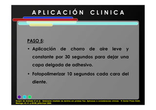 A P L I C A C I Ó N C L I N I C A
PASOPASO 55:
• Aplicación de chorro de aire leve y
constante por 30 segundos para dejar unaconstante por 30 segundos para dejar una
capa delgada de adhesivo.
• Fotopolimerizar 10 segundos cada cara del
diente.
Scopin de Andrade O et al. Selamento imediato da dentina em protese fixa. Aplicacao e consideracoes clínicas. R Dental Press Estét,
Maringa, v5, n1, p 55-68, ja/fev/mar/ 2008.
 