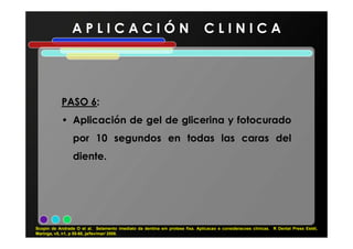 A P L I C A C I Ó N C L I N I C A
PASOPASO 66:
• Aplicación de gel de glicerina y fotocurado• Aplicación de gel de glicerina y fotocurado
por 10 segundos en todas las caras del
diente.
Scopin de Andrade O et al. Selamento imediato da dentina em protese fixa. Aplicacao e consideracoes clínicas. R Dental Press Estét,
Maringa, v5, n1, p 55-68, ja/fev/mar/ 2008.
 