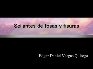 Sellantes de fosas y fisuras
Edgar Daniel Vargas Quiroga
 