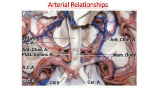 Arterial Relationships
 