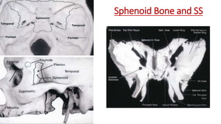 Sphenoid Bone and SS
 